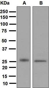 Western blot analysis on (A) fetal muscle and (B) human heart lysates using anti-Myosin Light Chain 4 antibody.