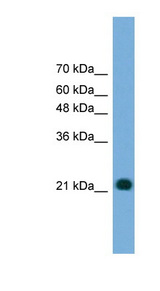 MYL4 antibody LS-C117116 Western blot of Transfected 293T cell lysate.