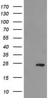 HEK293T cells were transfected with the pCMV6-ENTRY control (Left lane) or pCMV6-ENTRY MYL7 (Right lane) cDNA for 48 hrs and lysed. Equivalent amounts of cell lysates (5 ug per lane) were separated by SDS-PAGE and immunoblotted with anti-MYL7.