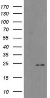 HEK293T cells were transfected with the pCMV6-ENTRY control (Left lane) or pCMV6-ENTRY MYL7 (Right lane) cDNA for 48 hrs and lysed. Equivalent amounts of cell lysates (5 ug per lane) were separated by SDS-PAGE and immunoblotted with anti-MYL7.