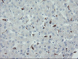 IHC of paraffin-embedded Human liver tissue using anti-MYL7 mouse monoclonal antibody.