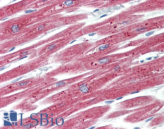 Anti-MLC2a / MYL7 antibody IHC staining of human heart. Immunohistochemistry of formalin-fixed, paraffin-embedded tissue after heat-induced antigen retrieval.
