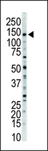 Western blot of anti-MLCK-long antibody in mouse brain tissue lysate. MLCK-long (Arrow) was detected using purified antibody. Secondary HRP-anti-rabbit was used for signal visualization with chemiluminescence.