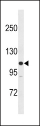 MLCK Antibody (M1) western blot of SK-BR-3 cell line lysates (35 ug/lane). The MLCK antibody detected the MLCK protein (arrow).