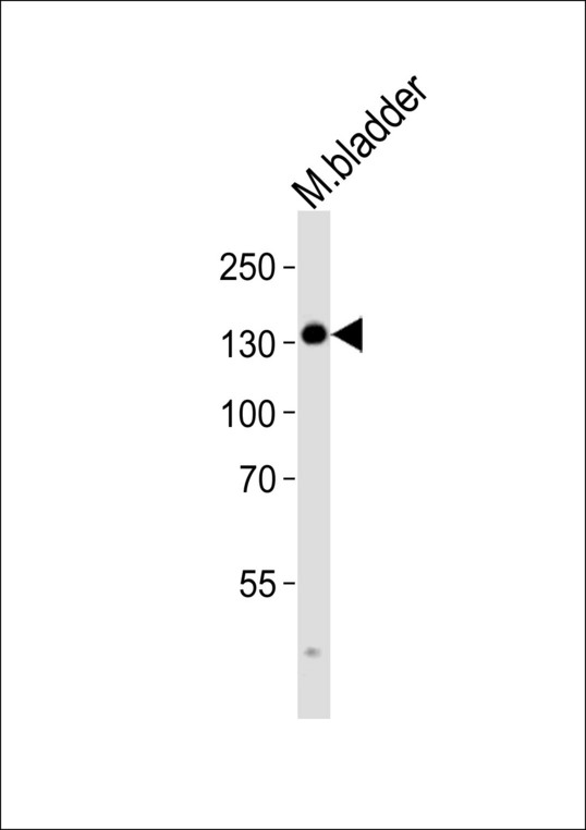 Western blot of lysate from mouse bladder tissue lysate, using MLCKlong Antibody (M1). Antibody was diluted at 1:1000. A goat anti-rabbit IgG H&L (HRP) at 1:10000 dilution was used as the secondary antibody. Lysate at 35ug.