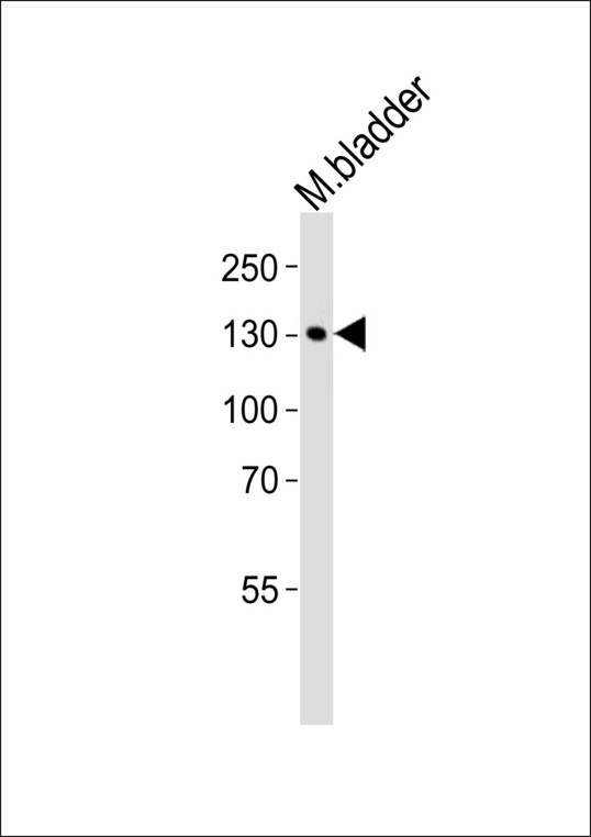 Western blot of lysate from mouse bladder tissue lysate, using MLCKlong Antibody (M1). Antibody was diluted at 1:1000. A goat anti-rabbit IgG H&L (HRP) at 1:10000 dilution was used as the secondary antibody. Lysate at 35ug.