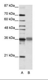 A: Marker, B: HepG2 Cell Lysate