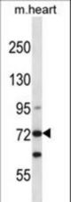 Mouse Mylk3 Antibody western blot of mouse heart tissue lysates (35 ug/lane). The Mylk3 antibody detected the Mylk3 protein (arrow).