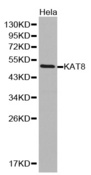 Western blot analysis of extracts of HeLa cell lines, using KAT8 antibody.