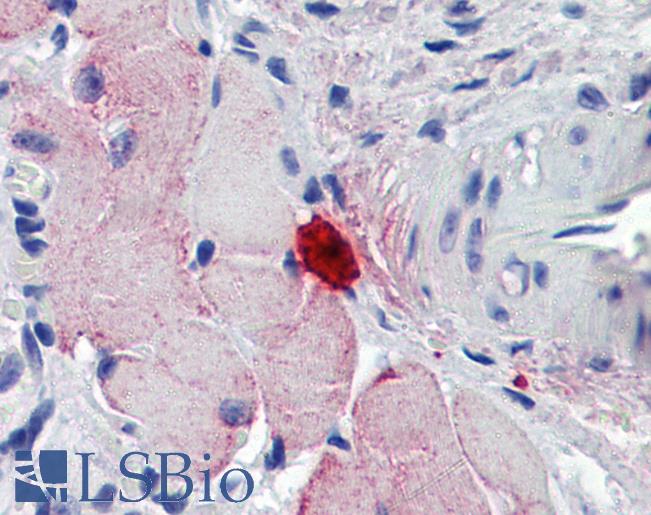 Anti-MCPT4 antibody IHC of mouse skeletal muscle, mast cell. Immunohistochemistry of formalin-fixed, paraffin-embedded tissue after heat-induced antigen retrieval. Antibody LS-B5958 concentration 3.75 ug/ml.