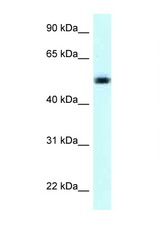 NAPRT1 antibody LS-C145966 Western blot of Jurkat Cell lysate. Antibody concentration 1 ug/ml.