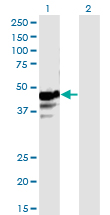 Western blot of NAPRT1 expression in transfected 293T cell line by NAPRT1 monoclonal antibody (M01), clone 4A9.