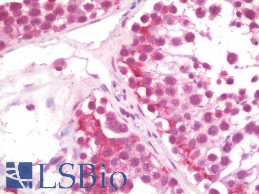 Anti-TLX3 antibody IHC staining of human testis. Immunohistochemistry of formalin-fixed, paraffin-embedded tissue after heat-induced antigen retrieval. Antibody LS-B10111 concentration 10 ug/ml.