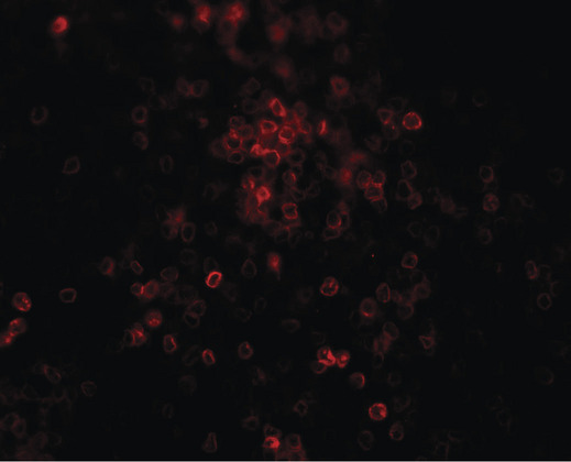 Immunofluorescence of TLX3 in human spleen tissue with TLX3 antibody at 20 ug/ml.