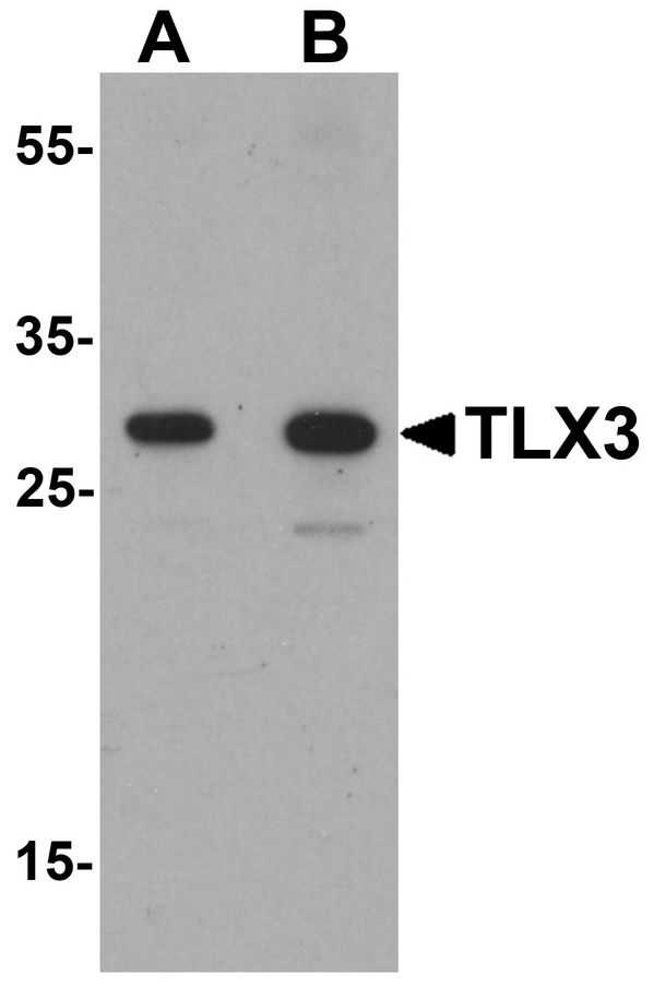 Western blot analysis of TLX3 in human spleen tissue lysate with TLX3 antibody at (A) 0.5 and (B) 1 ug/ml.