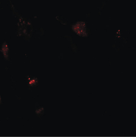 Immunofluorescence of NIBRIN in human lung tissue with NIBRIN antibody at 20 ug/ml.