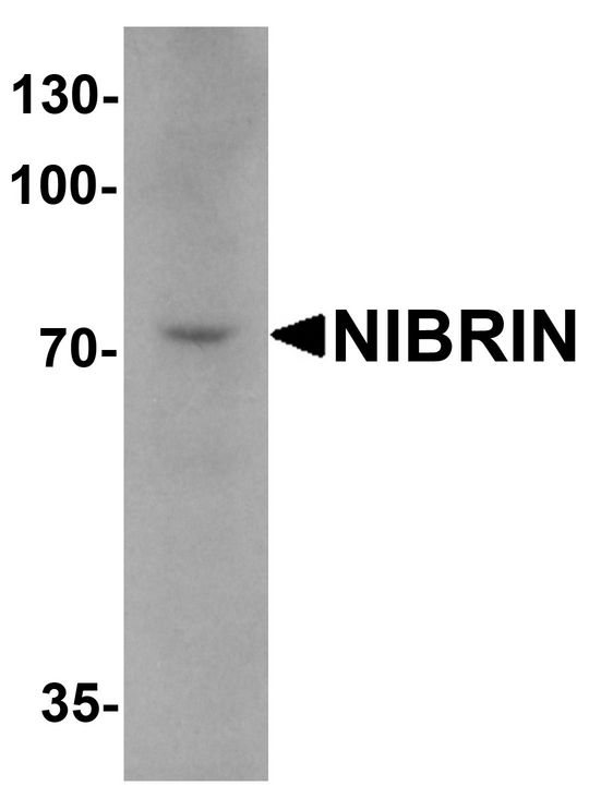Western blot analysis of NIBRIN in mouse lung tissue lysate with NIBRIN antibody at 1 ug/ml.