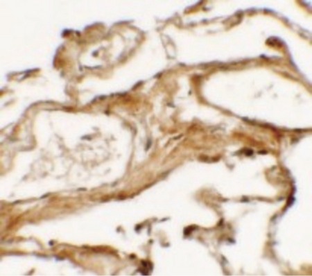 Immunohistochemistry of NIBRIN (NT) in human lung tissue with NIBRIN (NT) antibody at 2.5 ug/ml.