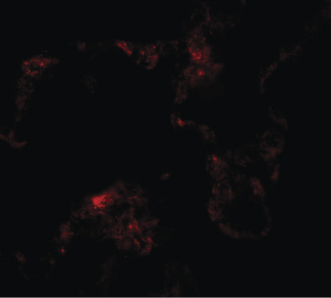 Immunofluorescence of NIBRIN in human lung tissue with NIBRIN antibody at 20 ug/ml.