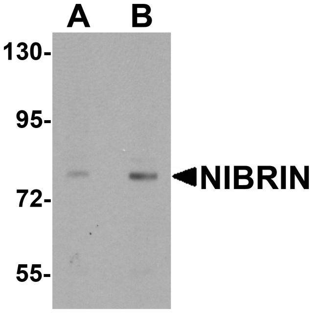 Western blot analysis of NIBRIN in rat lung tissue lysate with NIBRIN antibody at (A) 1 and (B) 2 ug/ml.