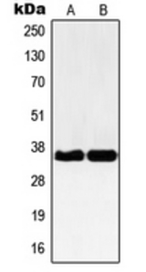 Western blot analysis of NBPF-pan expression in Jurkat (A); HEK293 (B) whole cell lysates.
