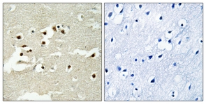 IHC of paraffin-embedded human brain tissue, using NCOA5 Antibody. The picture on the right is treated with the synthesized peptide.