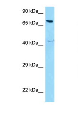 NCOA5 antibody LS-C146229 Western blot of MCF7 Cell lysate. Antibody concentration 1 ug/ml.
