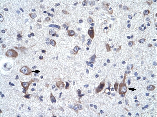 NCS1 / NCS-1 antibody LS-C30071 was used in IHC to stain formalin-fixed, paraffin-embedded human brain.