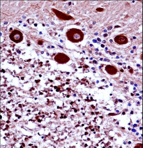 FREQ Antibody immunohistochemistry of formalin-fixed and paraffin-embedded human cerebellum tissue followed by peroxidase-conjugated secondary antibody and DAB staining.