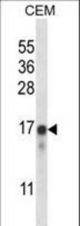 FREQ Antibody western blot of CEM cell line lysates (35 ug/lane). The FREQ antibody detected the FREQ protein (arrow).