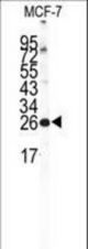 Western blot of NCS1 Antibody in MCF-7 cell line lysates (35 ug/lane). NCS1 (arrow) was detected using the purified antibody.