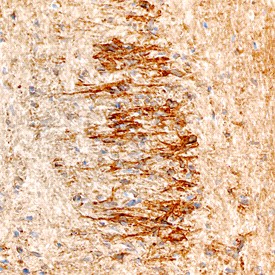 NELL1 in Mouse Embryo. NELL1 was detected in immersion fixed frozen sections of mouse embryo (13 d. p. c.) using Sheep Anti-Mouse NELL1 Antigen Affinity-purified Polyclonal Antibody at 5 ug/ml overnight at 4°C. Tissue was stained using Anti-Sheep HRP-DAB (brown) and counterstained with hematoxylin (blue). Specific staining was localized to neurons in the spinal cord.
