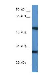 TM2D2 antibody LS-C135831 Western blot of Jurkat lysate.