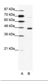 A: Marker, B: Jurkat Cell Lysate