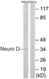 Western blot of extracts from HeLa cells, using Neuro D (Ab-274) Antibody. The lane on the right is treated with the synthesized peptide.