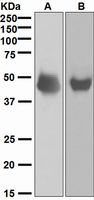 Western blot analysis on (A) Y79 and (B) fetal brain lysates using anti-NeuroD1 antibody.
