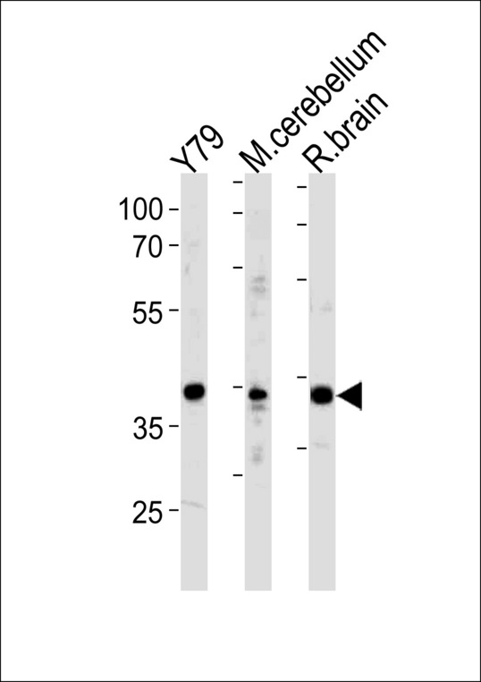 NeuroD1 Antibody (I333) western blot of Y79 cell line ,mouse cerebellum and rat brain tissue lysates (35 ug/lane). The NeuroD1 antibody detected the NeuroD1 protein (arrow).