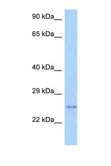TM2D3 antibody LS-C146142 Western blot of Mouse Heart lysate. Antibody concentration 1 ug/ml.