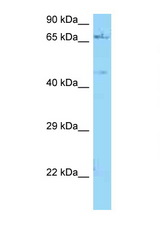 NGFR antibody LS-C146471 Western blot of ACHN Cell lysate. Antibody concentration 1 ug/ml.