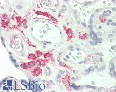 Human Placenta: Formalin-Fixed, Paraffin-Embedded (FFPE)