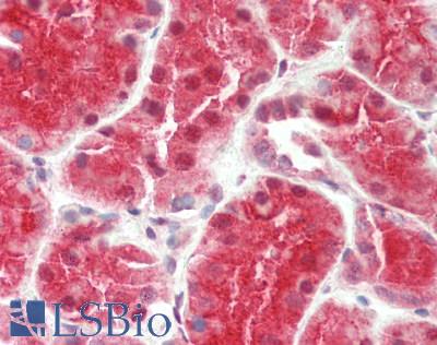 Human Kidney: Formalin-Fixed, Paraffin-Embedded (FFPE)