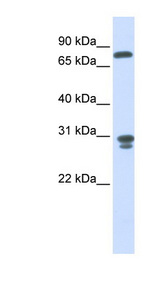 NIT2 antibody western blot of Human Fetal Liver lysate.