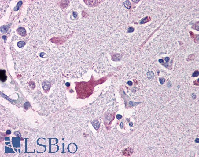 Anti-NALP2 antibody IHC of human brain, cortex. Immunohistochemistry of formalin-fixed, paraffin-embedded tissue after heat-induced antigen retrieval. Antibody LS-B529 concentration 5 ug/ml.