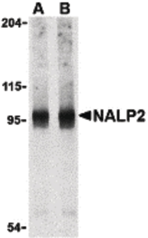 Western blot of NALP2 in PC-3 cell lysate with NALP2 antibody at (A) 1 and (B) 2 ug/ml.