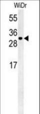 TM2D3 Antibody western blot of WiDr cell line lysates (35 ug/lane). The TM2D3 antibody detected the TM2D3 protein (arrow).