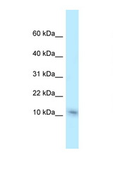 NME1 antibody LS-C145913 Western blot of Mouse Liver lysate. Antibody concentration 1 ug/ml.