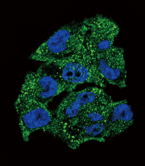 Confocal immunofluorescent of NM23 (NME1) Antibody with A375 cell followed by Alexa Fluor 488-conjugated goat anti-rabbit lgG (green). DAPI was used to stain the cell nuclear (blue).