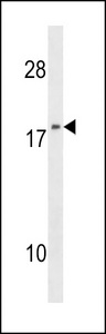 NME1 Antibody (F40) western blot of 293 cell line lysates (35 ug/lane). The NME1 antibody detected the NME1 protein (arrow).
