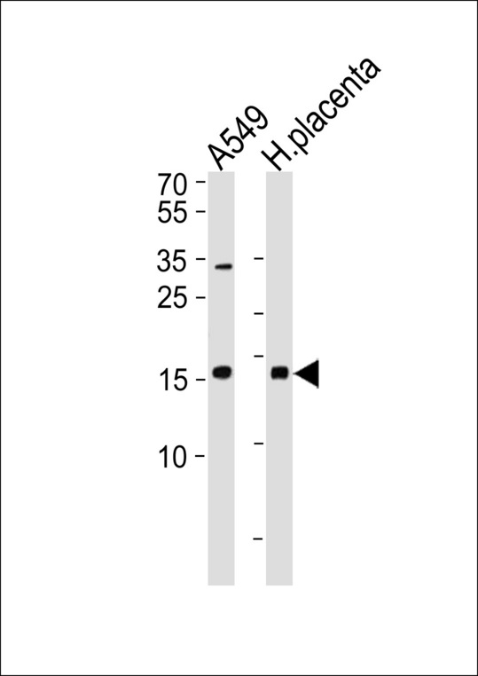 NME1 Antibody western blot of A549 cell line and human placenta lysates (35 ug/lane). The NME1 antibody detected the NME1 protein (arrow).
