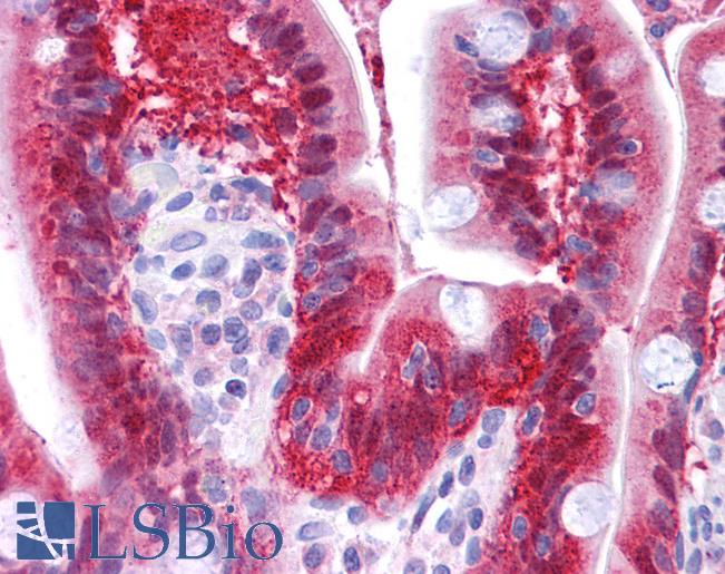 Anti-NME1 antibody IHC of human small intestine. Immunohistochemistry of formalin-fixed, paraffin-embedded tissue after heat-induced antigen retrieval. Antibody LS-B4689 concentration 5 ug/ml.